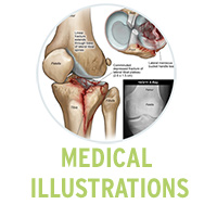 Legal X Ray Duplications
